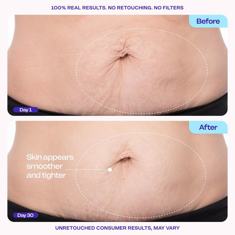Revitalize Your Confidence with GOPURE Tighten & Smooth Belly Firming Cream