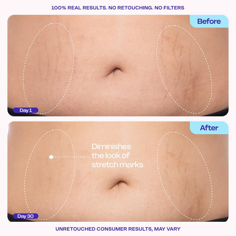 Revitalize Your Confidence with GOPURE Tighten & Smooth Belly Firming Cream