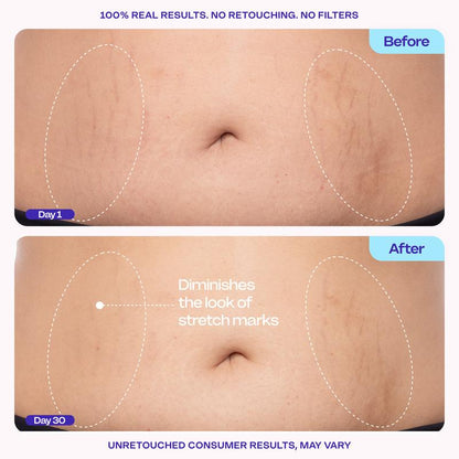 Revitalize Your Confidence with GOPURE Tighten & Smooth Belly Firming Cream
